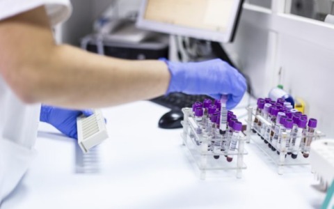 Scoperte tracce di Legionella nelle scuole di Lesmo